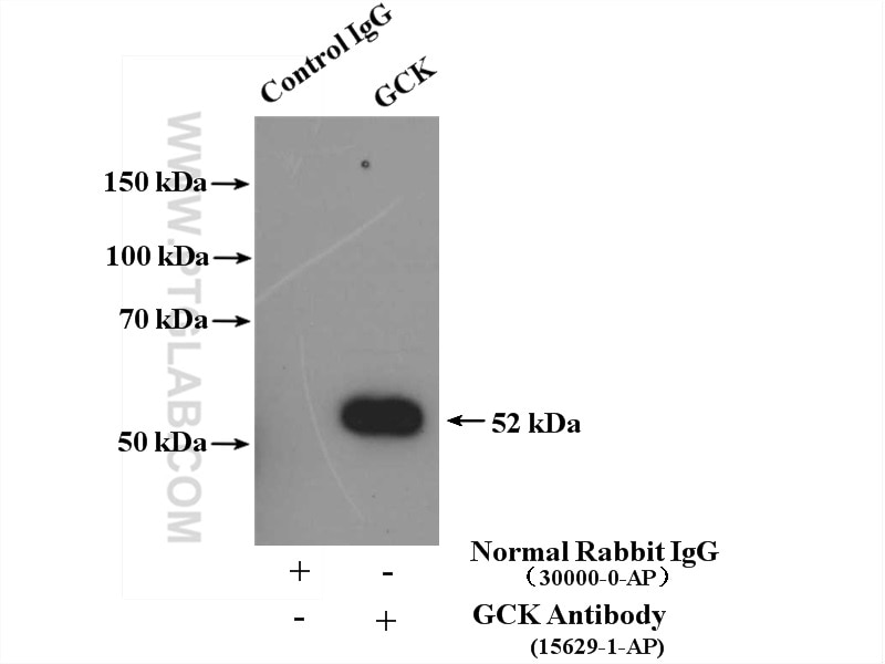 Immunoprecipitation (IP) experiment of mouse liver tissue using GCK Polyclonal antibody (15629-1-AP)