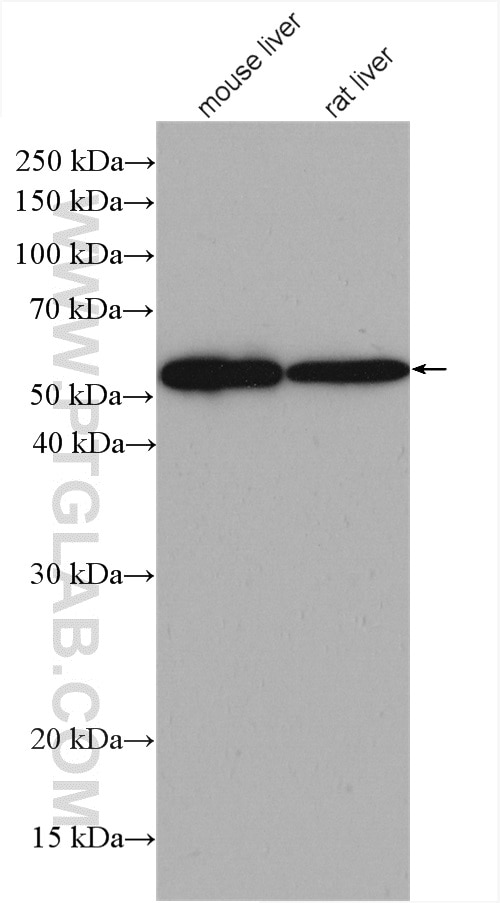 Western Blot (WB) analysis of various lysates using GCK Polyclonal antibody (15629-1-AP)