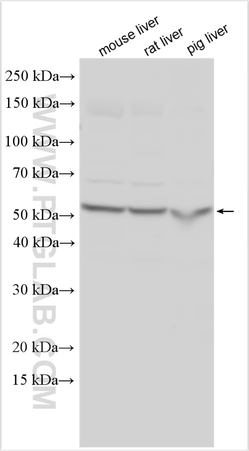 Western Blot (WB) analysis of various lysates using GCK Polyclonal antibody (15629-1-AP)