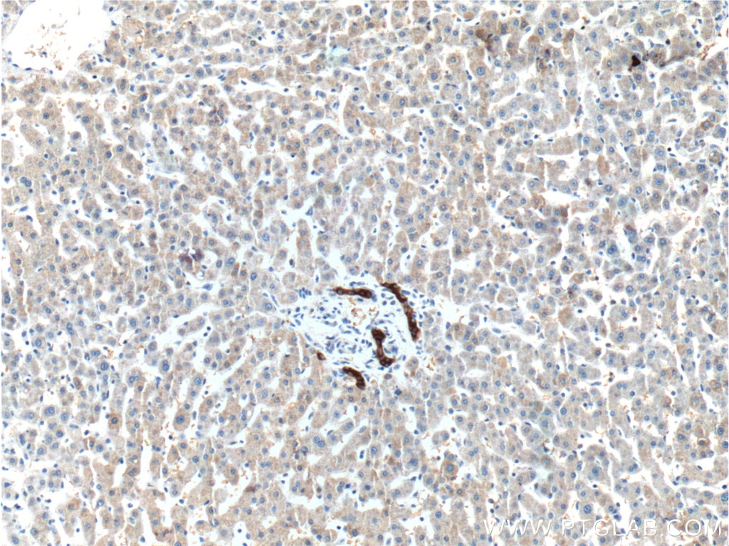 IHC staining of human liver using 19666-1-AP