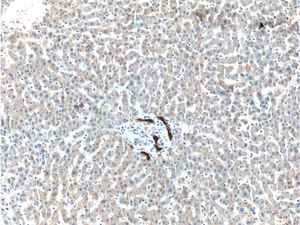 Immunohistochemistry (IHC) staining of human liver tissue using GCK Polyclonal antibody (19666-1-AP)