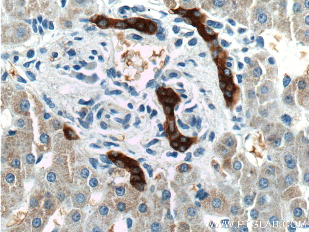 Immunohistochemistry (IHC) staining of human liver tissue using GCK Polyclonal antibody (19666-1-AP)
