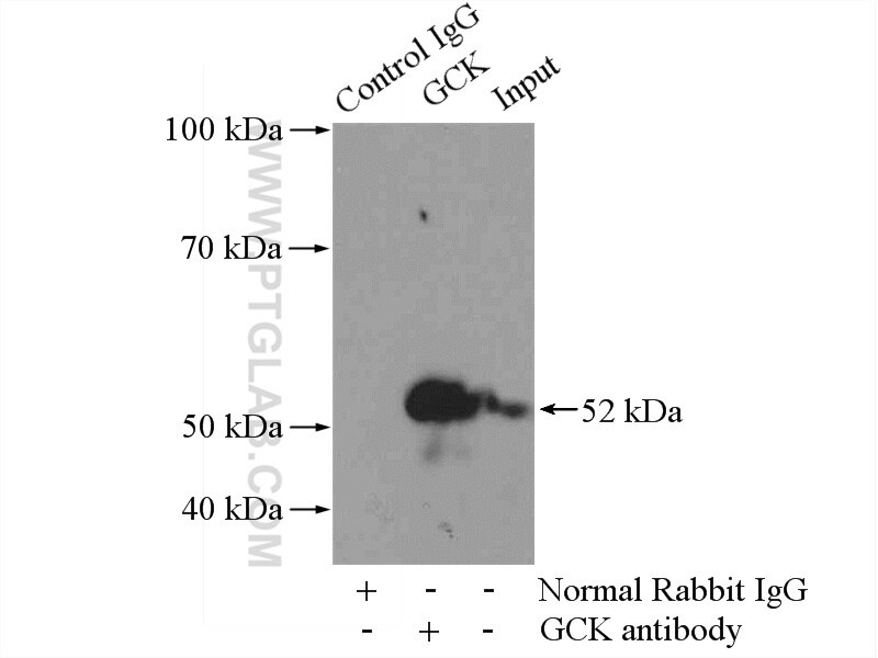 Immunoprecipitation (IP) experiment of mouse liver tissue using GCK Polyclonal antibody (19666-1-AP)