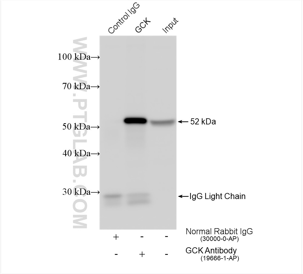 Immunoprecipitation (IP) experiment of mouse liver tissue using GCK Polyclonal antibody (19666-1-AP)