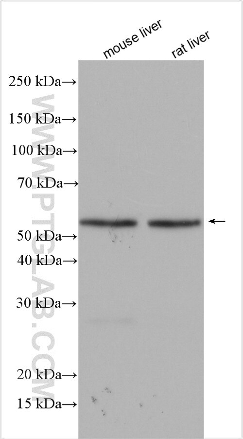 Western Blot (WB) analysis of various lysates using GCK Polyclonal antibody (19666-1-AP)