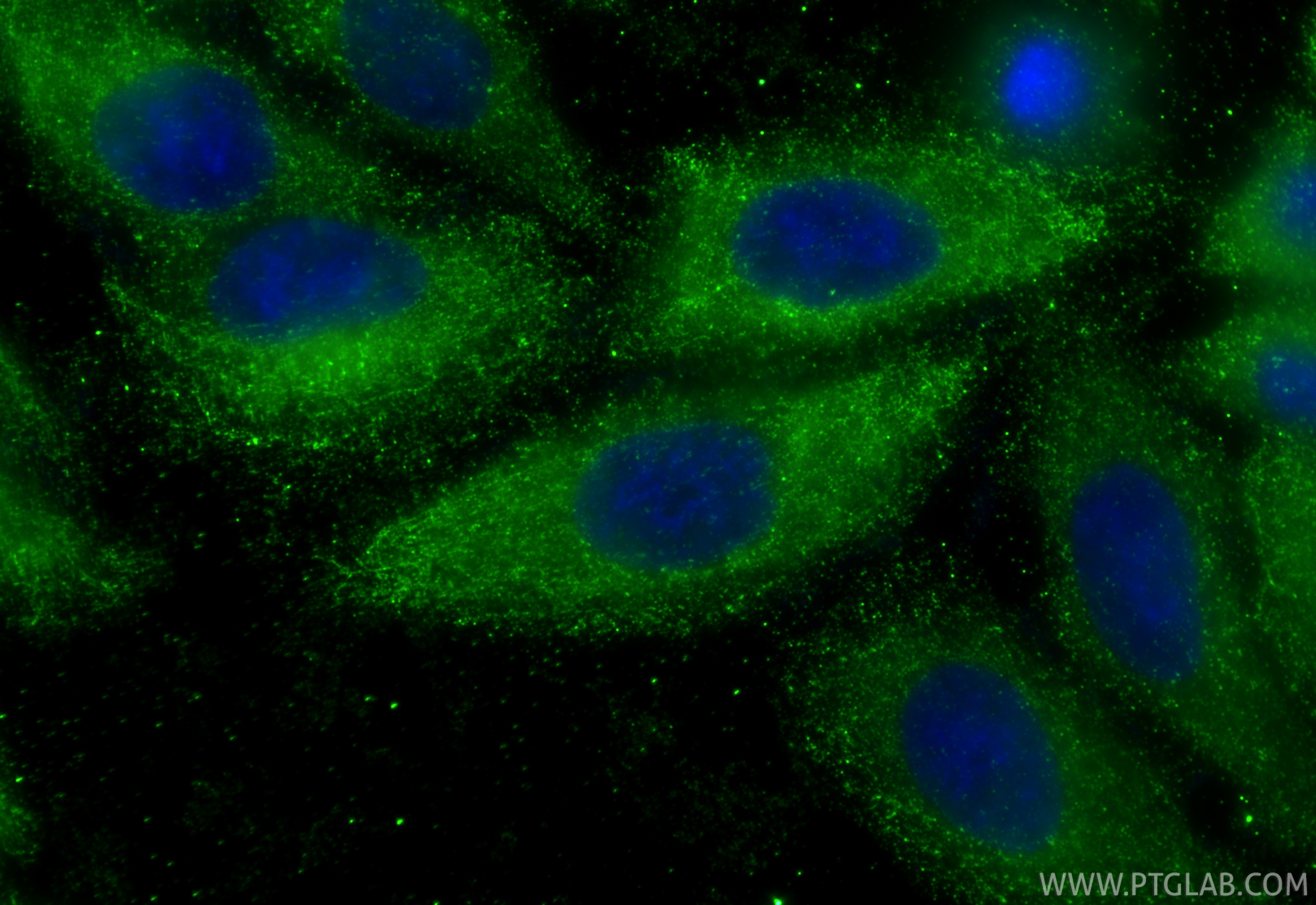 Immunofluorescence (IF) / fluorescent staining of HepG2 cells using GCK Monoclonal antibody (67216-1-Ig)