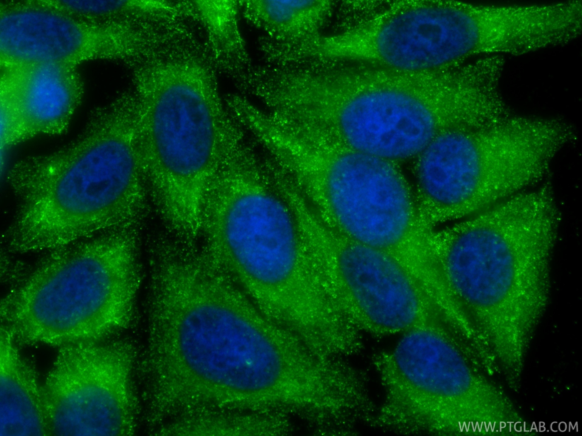 IF Staining of HepG2 using 67216-1-Ig Immunofluorescence (IF) / fluorescent staining of HepG2 cells using GCK Monoclonal antibody (67216-1-Ig)