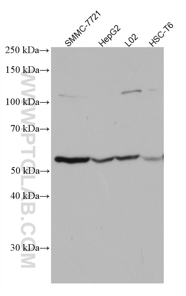 Western Blot (WB) analysis of various lysates using GCK Monoclonal antibody (67216-1-Ig)