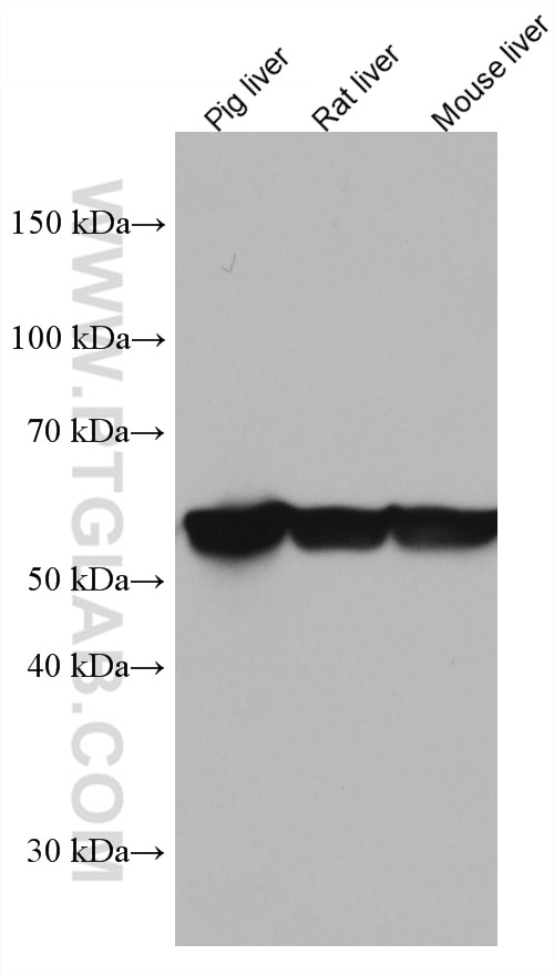 Western Blot (WB) analysis of various lysates using GCK Monoclonal antibody (67216-1-Ig)