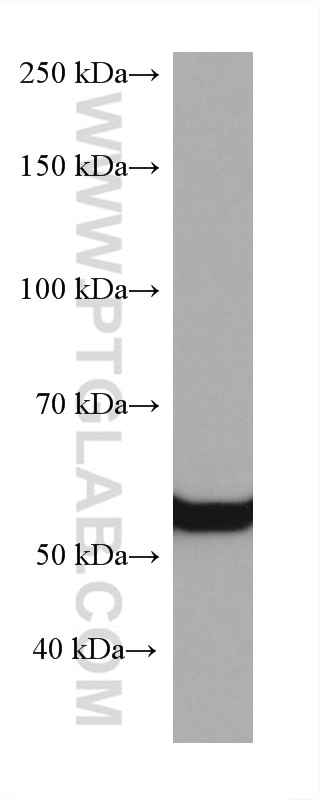 Western Blot (WB) analysis of rat liver tissue using GCK Monoclonal antibody (67216-1-Ig)