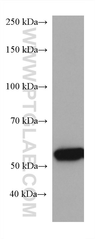 Western Blot (WB) analysis of pig liver tissue using GCK Monoclonal antibody (67216-1-Ig)