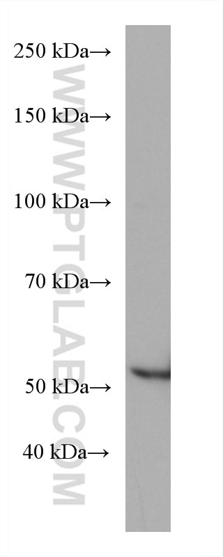 Western Blot (WB) analysis of HSC-T6 cells using GCK Monoclonal antibody (67216-1-Ig)