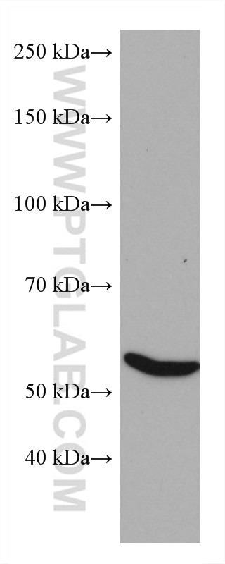 Western Blot (WB) analysis of SMMC-7721 cells using GCK Monoclonal antibody (67216-1-Ig)