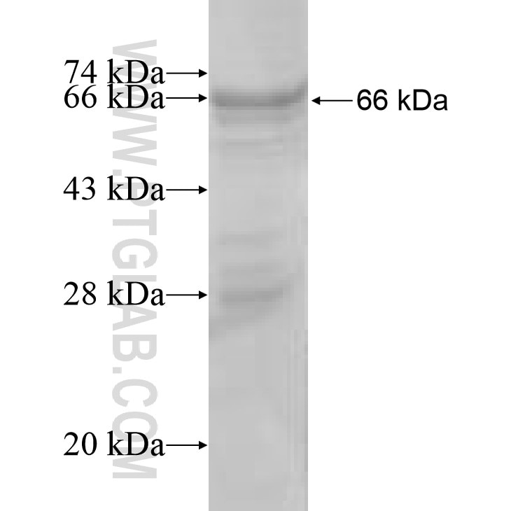 GCK fusion protein Ag7904 SDS-PAGE