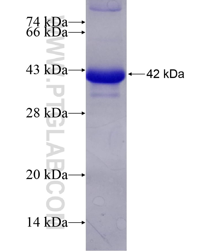 GCK fusion protein Ag8116 SDS-PAGE