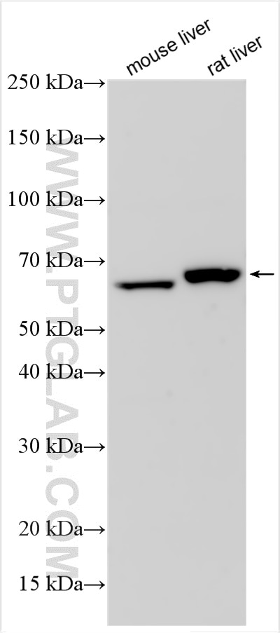 Western Blot (WB) analysis of various lysates using GCKR Polyclonal antibody (26042-1-AP)