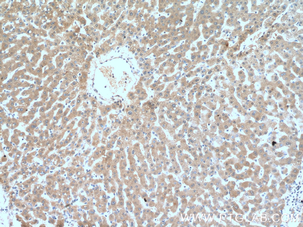 Immunohistochemistry (IHC) staining of human liver tissue using GCLC Polyclonal antibody (12601-1-AP)