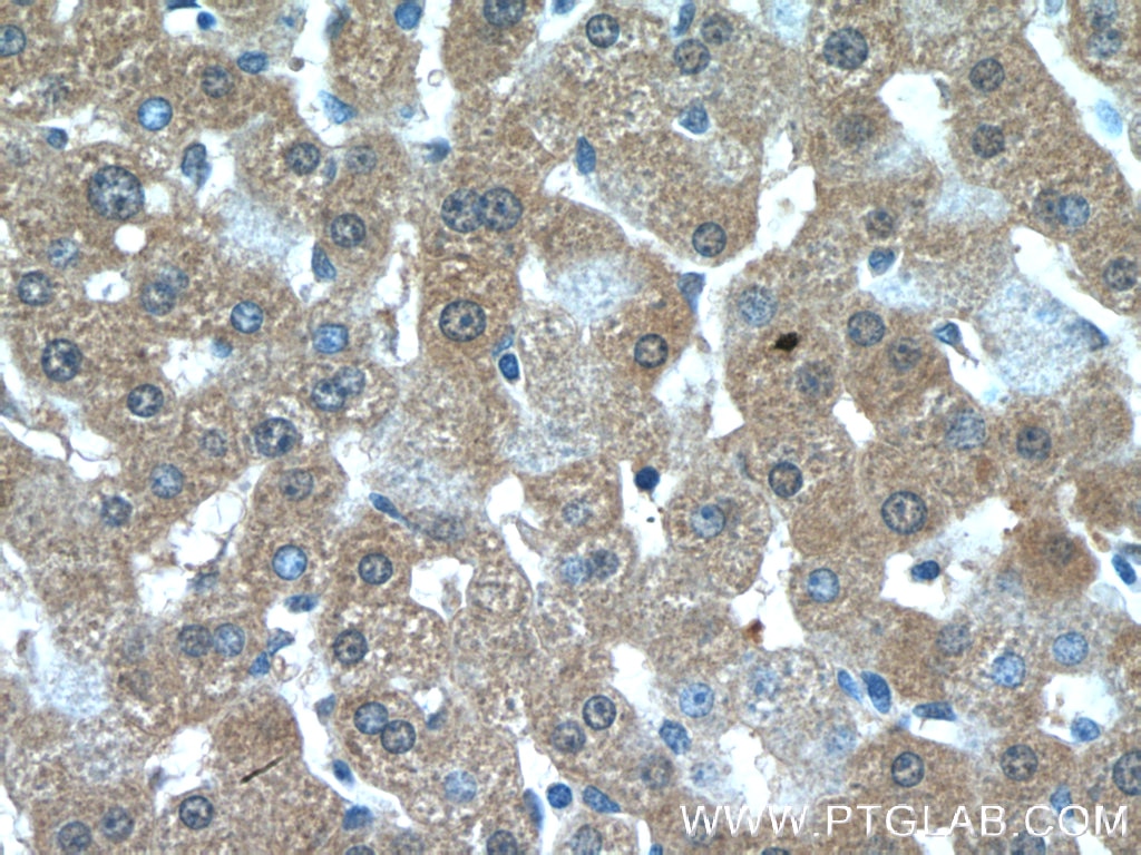 Immunohistochemistry (IHC) staining of human liver tissue using GCLC Polyclonal antibody (12601-1-AP)