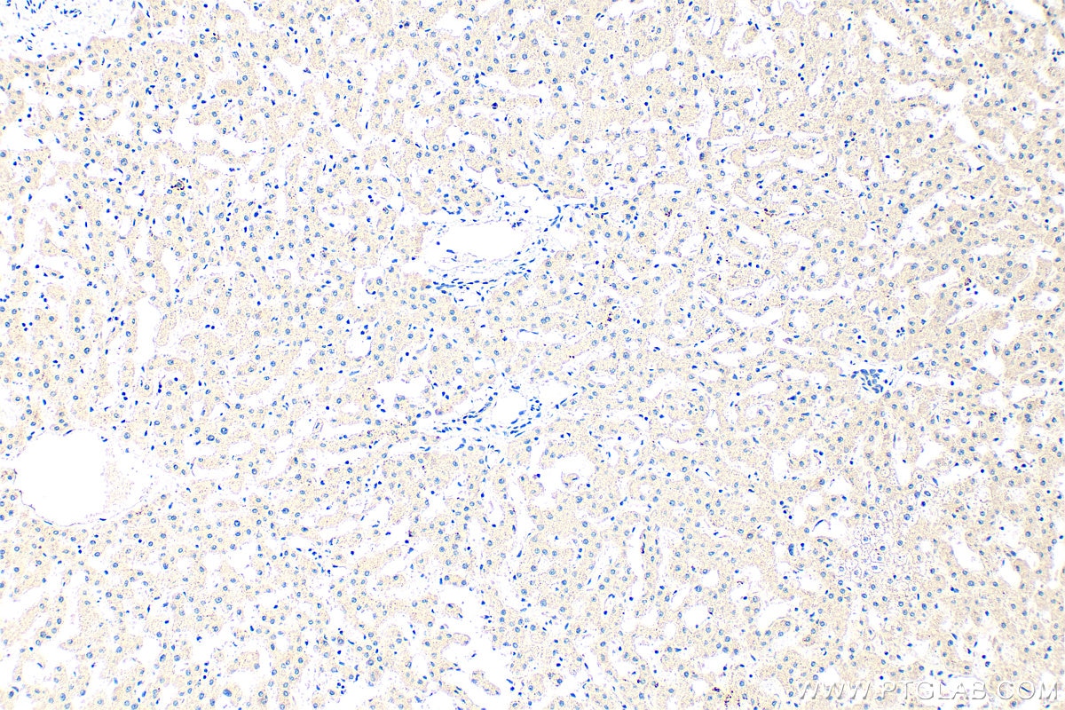 Immunohistochemistry (IHC) staining of human liver tissue using GCLC Polyclonal antibody (12601-1-AP)