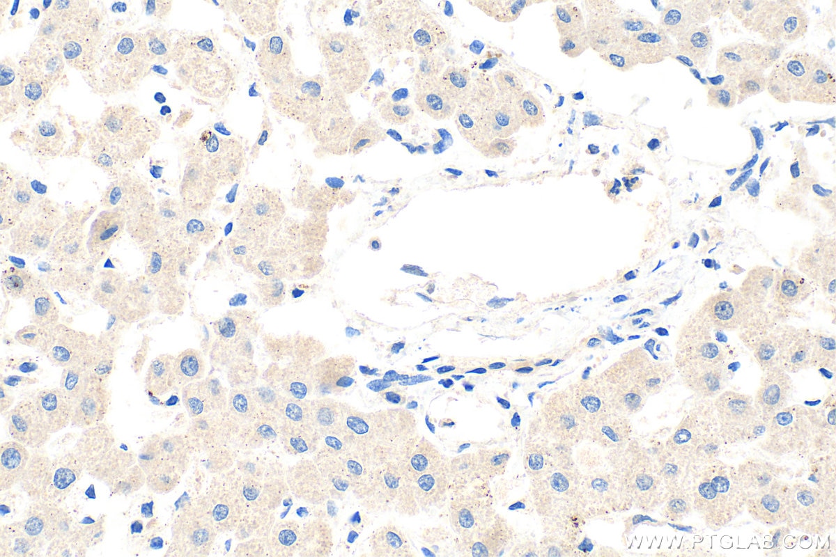 Immunohistochemistry (IHC) staining of human liver tissue using GCLC Polyclonal antibody (12601-1-AP)