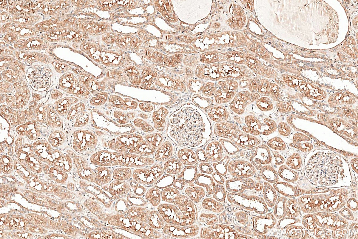 Immunohistochemistry (IHC) staining of human kidney tissue using GCLC Polyclonal antibody (12601-1-AP)
