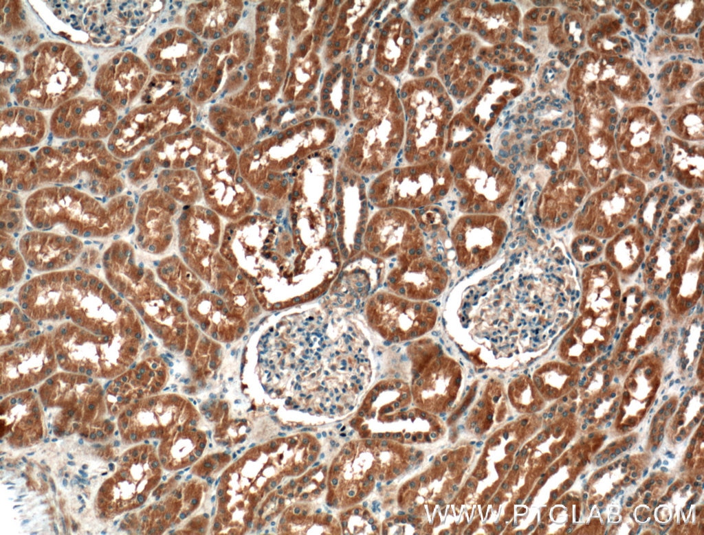 Immunohistochemistry (IHC) staining of human kidney tissue using GCLC Polyclonal antibody (12601-1-AP)