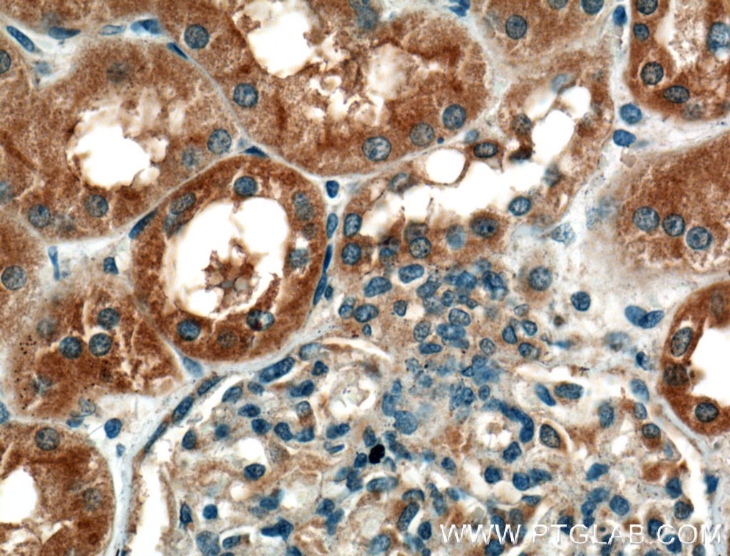 Immunohistochemistry (IHC) staining of human kidney tissue using GCLC Polyclonal antibody (12601-1-AP)