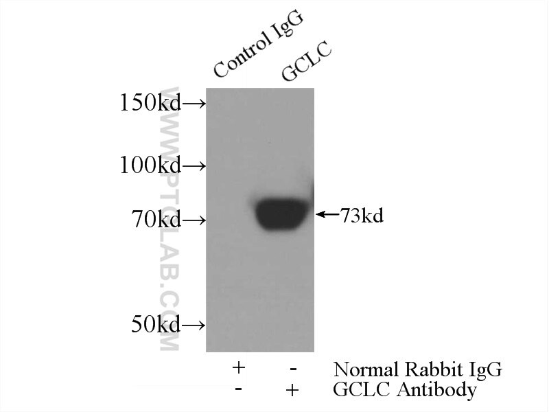 Immunoprecipitation (IP) experiment of mouse kidney tissue using GCLC Polyclonal antibody (12601-1-AP)