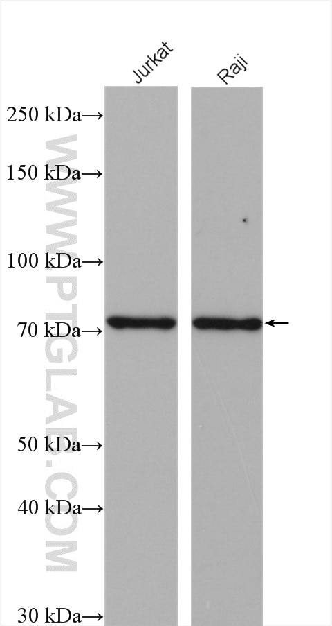 Western Blot (WB) analysis of various lysates using GCLC Polyclonal antibody (12601-1-AP)