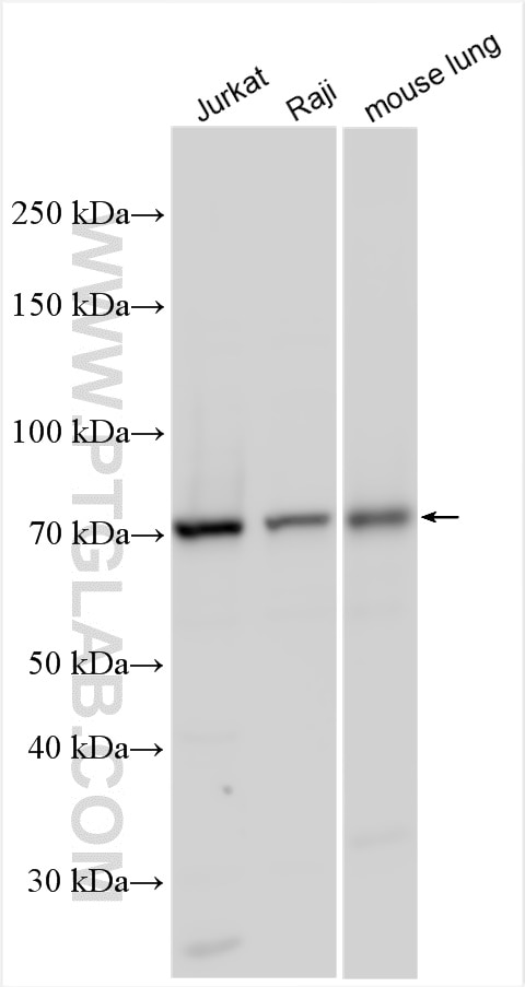Western Blot (WB) analysis of various lysates using GCLC Polyclonal antibody (12601-1-AP)