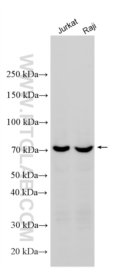 Western Blot (WB) analysis of various lysates using GCLC Polyclonal antibody (12601-1-AP)