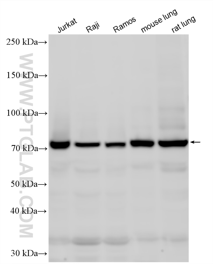 Western Blot (WB) analysis of various lysates using GCLC Polyclonal antibody (12601-1-AP)
