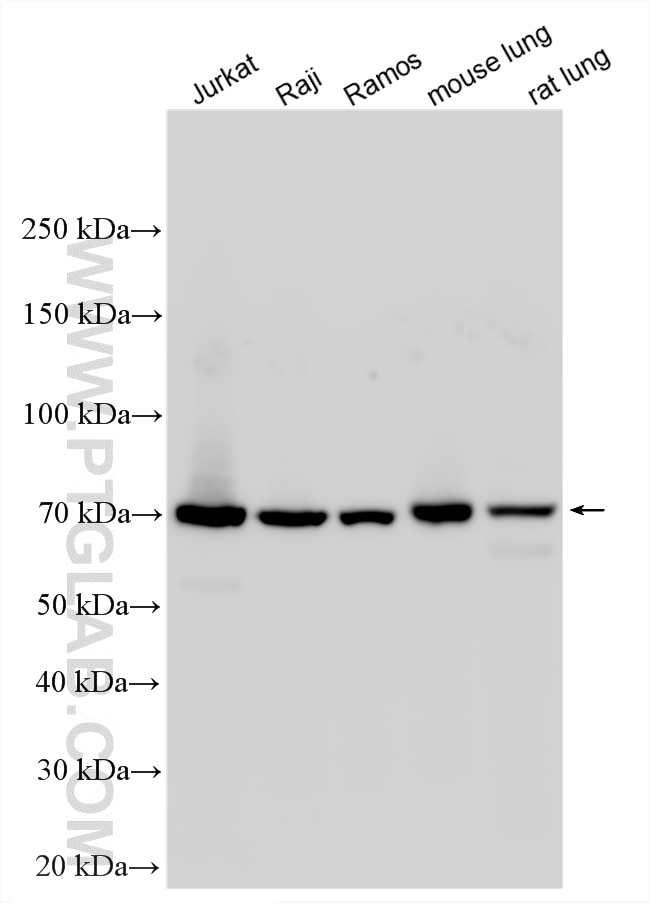 Western Blot (WB) analysis of various lysates using GCLC Polyclonal antibody (12601-1-AP)