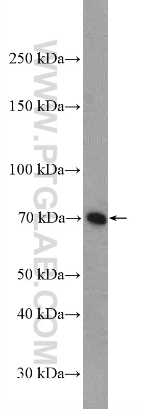 Western Blot (WB) analysis of L02 cells using GCLC Polyclonal antibody (12601-1-AP)