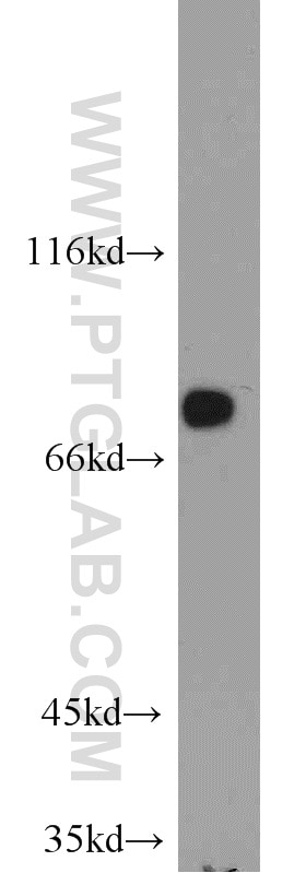 Western Blot (WB) analysis of mouse kidney tissue using GCLC Polyclonal antibody (12601-1-AP)