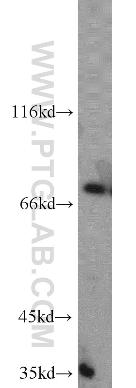 Western Blot (WB) analysis of HEK-293 cells using GCLC Polyclonal antibody (12601-1-AP)