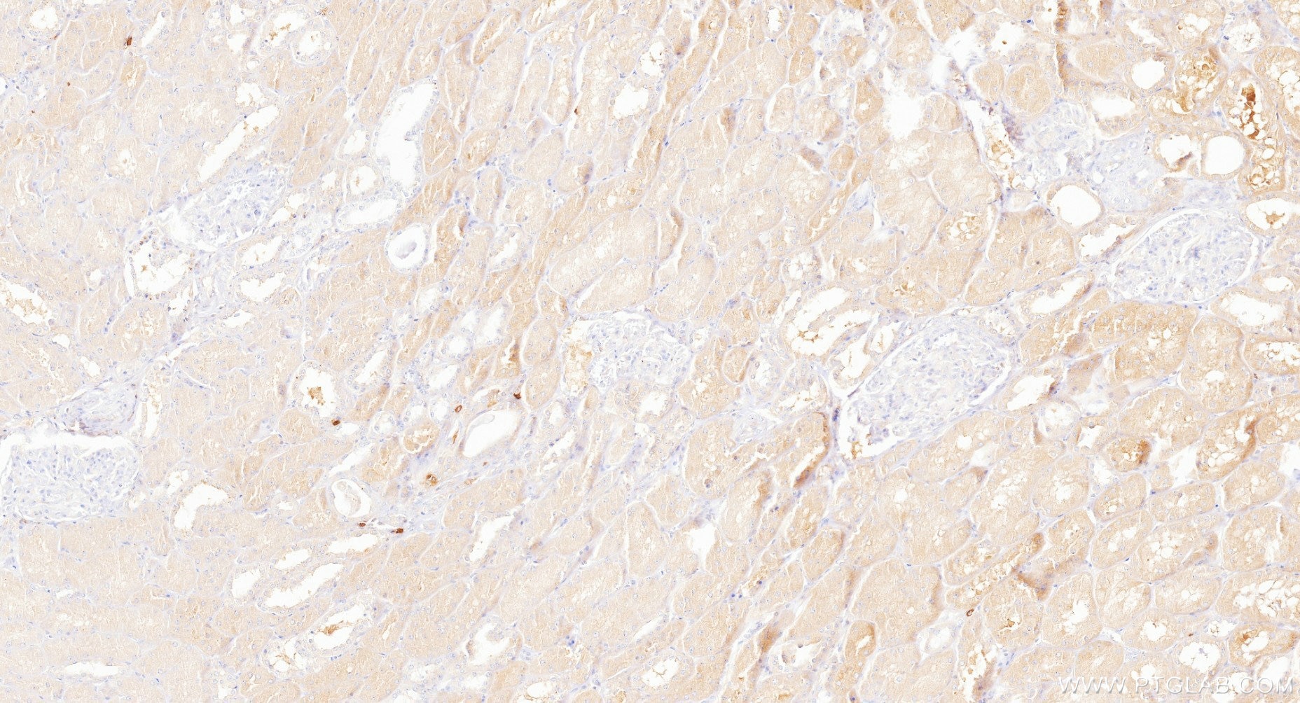 IHC staining of human kidney using 88062-1-RR (same clone as 88062-1-PBS) Immunohistochemistry (IHC) staining of human kidney tissue using GCLC Recombinant monoclonal antibody (88062-1-RR)