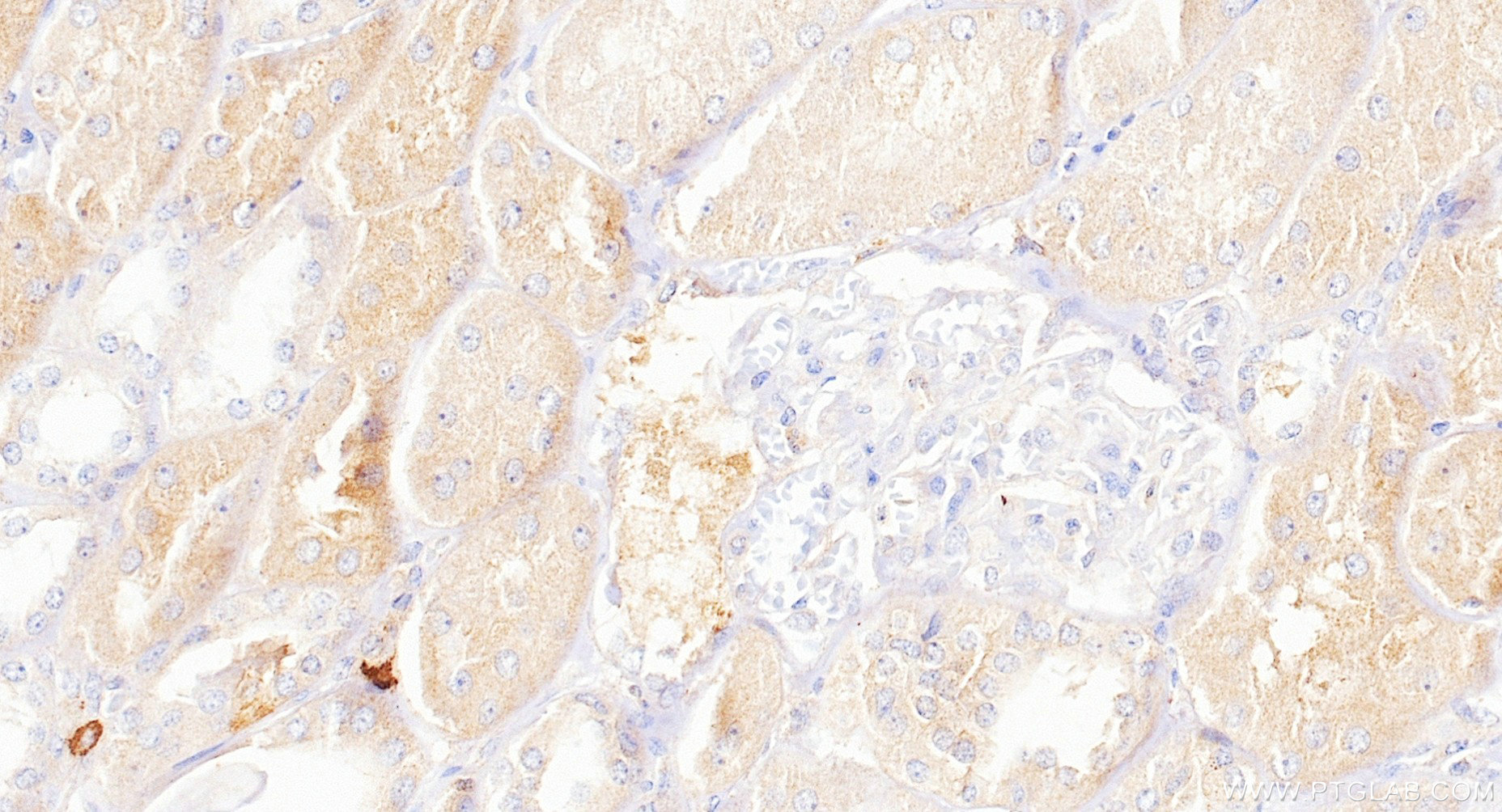 IHC staining of human kidney using 88062-1-RR (same clone as 88062-1-PBS) Immunohistochemistry (IHC) staining of human kidney tissue using GCLC Recombinant monoclonal antibody (88062-1-RR)