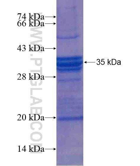 GCLC fusion protein Ag18847 SDS-PAGE