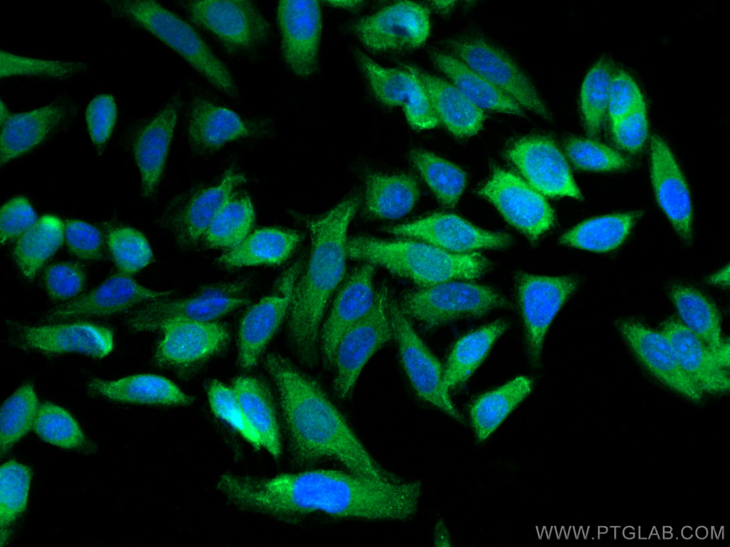 Immunofluorescence (IF) / fluorescent staining of HepG2 cells using GCLM Polyclonal antibody (14241-1-AP)