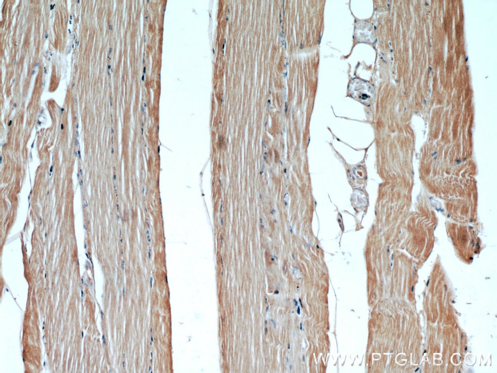 IHC staining of human skeletal muscle using 14241-1-AP