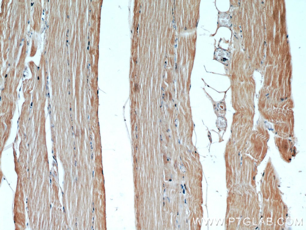 Immunohistochemistry (IHC) staining of human skeletal muscle tissue using GCLM Polyclonal antibody (14241-1-AP)