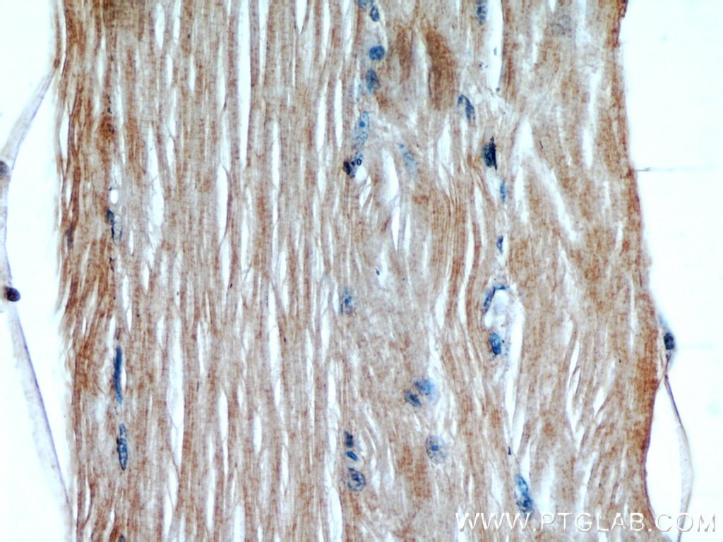 Immunohistochemistry (IHC) staining of human skeletal muscle tissue using GCLM Polyclonal antibody (14241-1-AP)