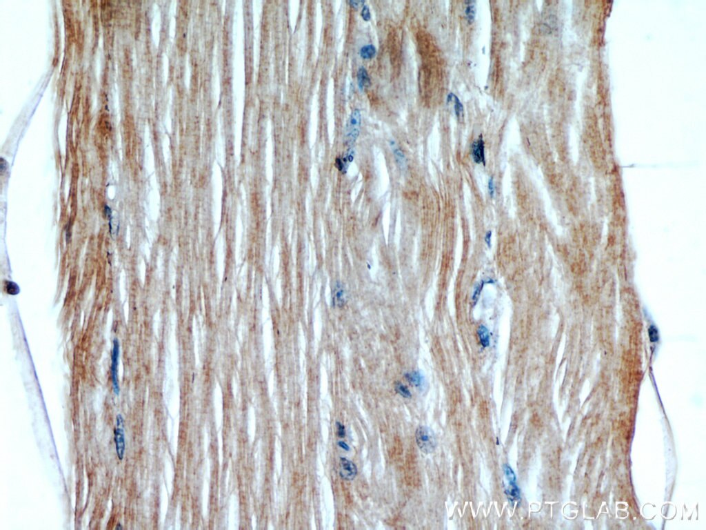 Immunohistochemistry (IHC) staining of human skeletal muscle tissue using GCLM Polyclonal antibody (14241-1-AP)