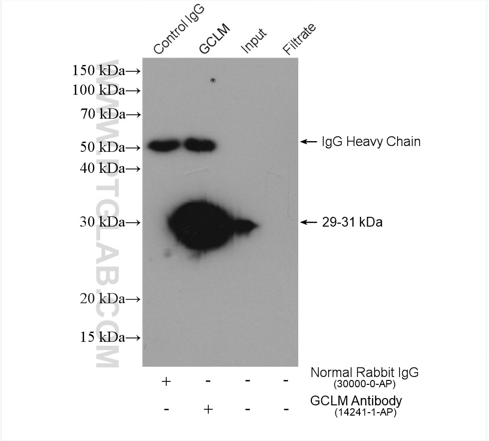 Immunoprecipitation (IP) experiment of A431 cells using GCLM Polyclonal antibody (14241-1-AP)