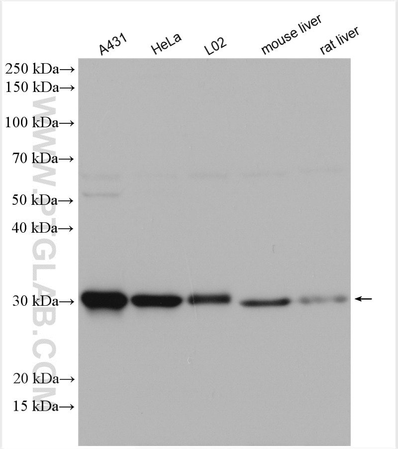 Western Blot (WB) analysis of various lysates using GCLM Polyclonal antibody (14241-1-AP)