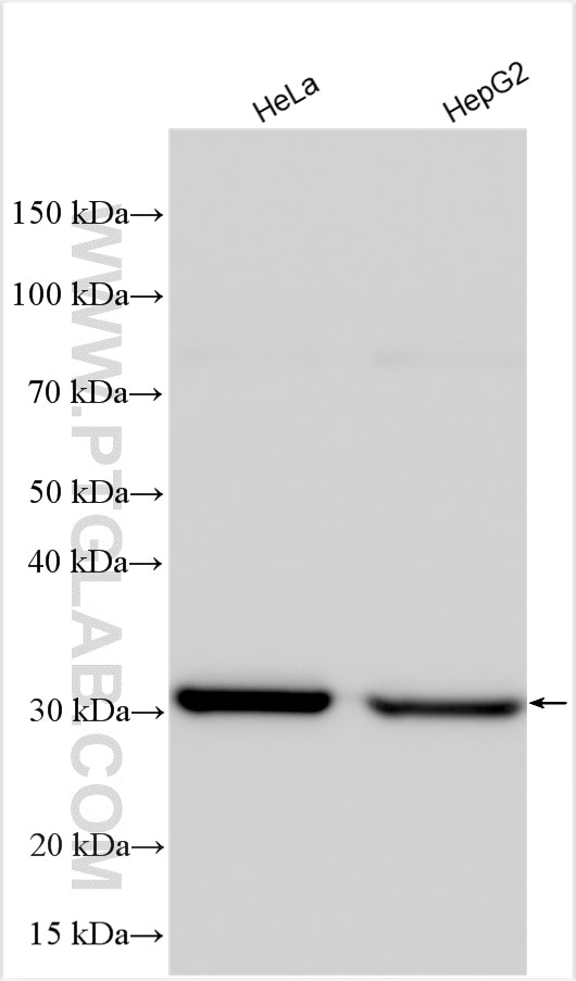 Western Blot (WB) analysis of various lysates using GCLM Polyclonal antibody (14241-1-AP)