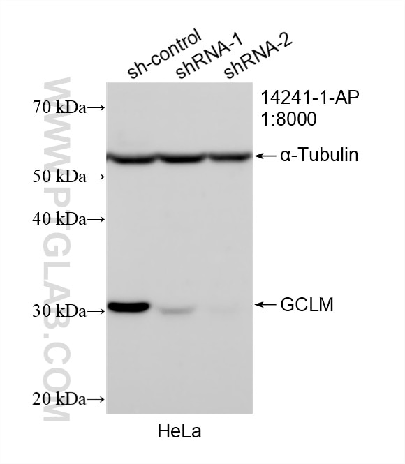 Western Blot (WB) analysis of HeLa cells using GCLM Polyclonal antibody (14241-1-AP)