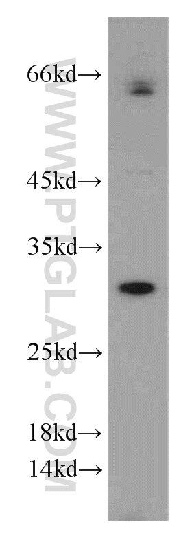 Western Blot (WB) analysis of MCF-7 cells using GCLM Polyclonal antibody (14241-1-AP)