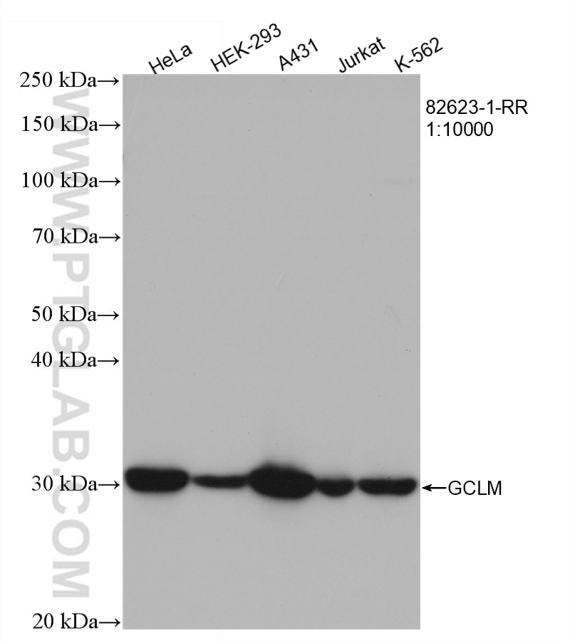 Western Blot (WB) analysis of various lysates using GCLM Recombinant antibody (82623-1-RR)
